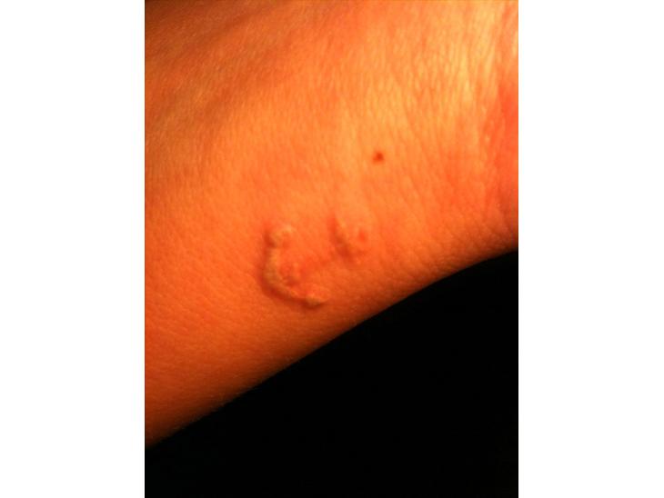 {{currentPhoto.altText}} billede {{currentPhoto.number}}