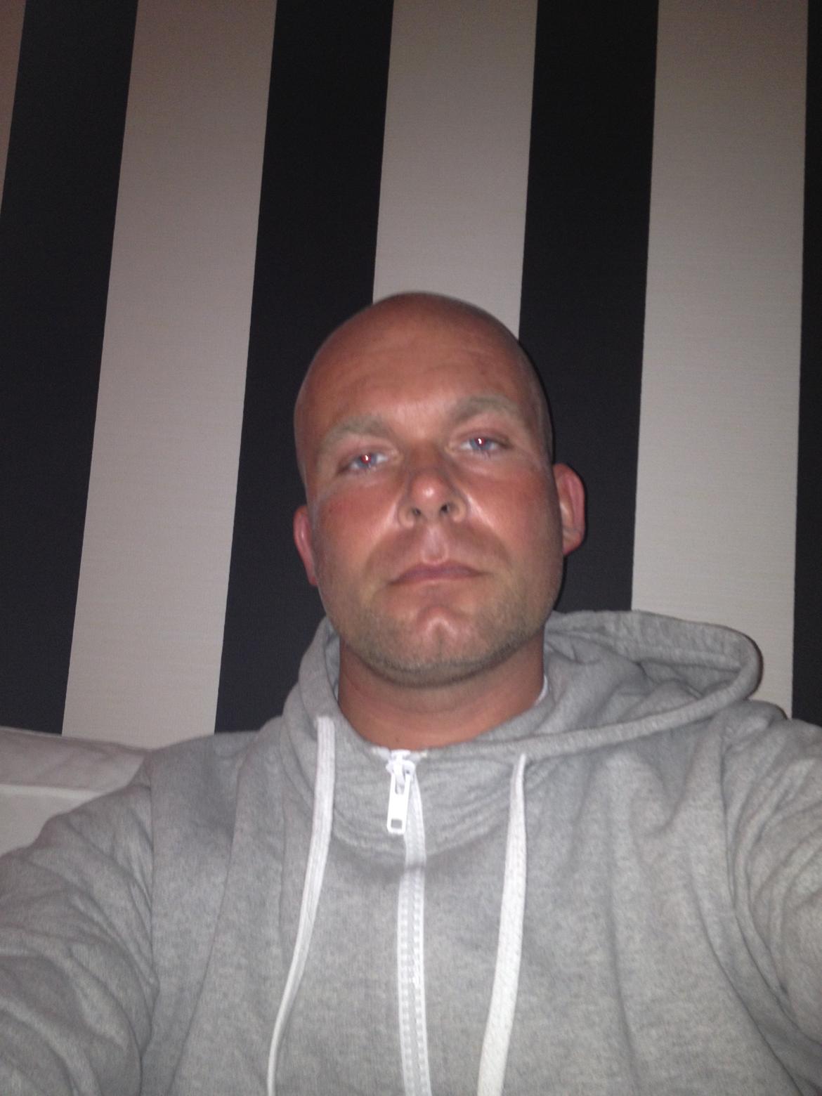 Mand bissen007 billede 4