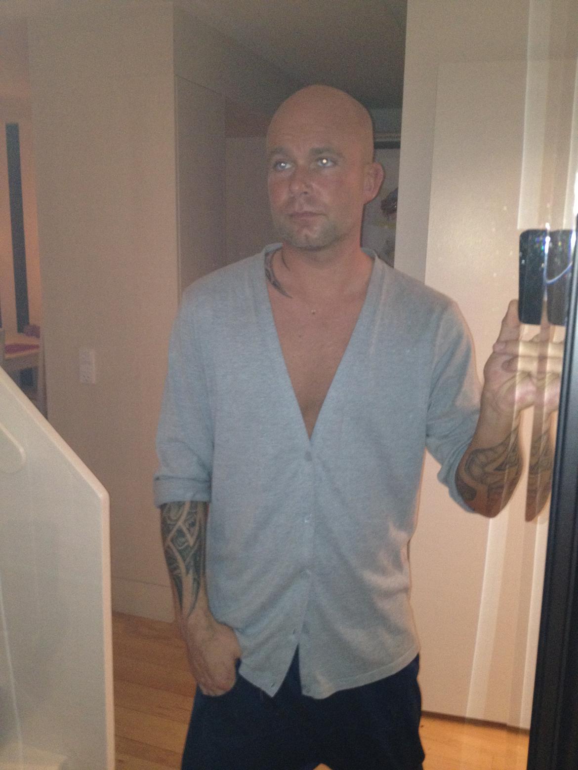 Mand bissen007 billede 5