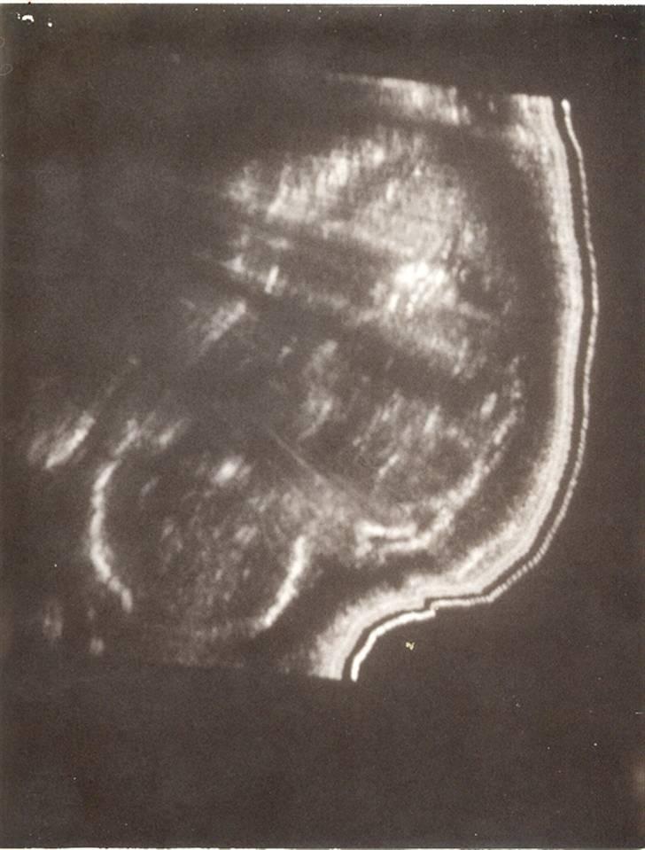 Kvinde Vibber - Mig fra før jeg blev født... Bemærk den sexede frisure... ;-p billede 4