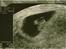 Scannings billeder - Ekstra scanning d.26/10-09
