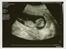 Scannings billeder - NF-scanning d.1/12-09  *13+0*