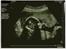 Scannings billeder - MD-scanning d.13/1-10 *19+1*