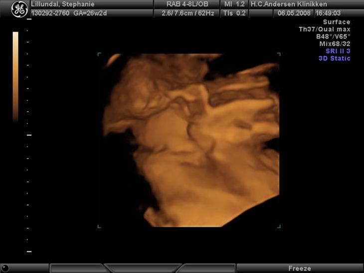 {{currentPhoto.altText}} billede {{currentPhoto.number}}