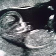 Min første graviditet :)