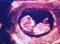 Baby ´s Hule - uge 12