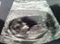 Baby 2012 - Nakkefoldscanning :)
