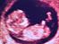 Baby ´s Hule - Lille C, første billede - så fin <3 Uge 12