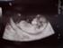 Baby scanning