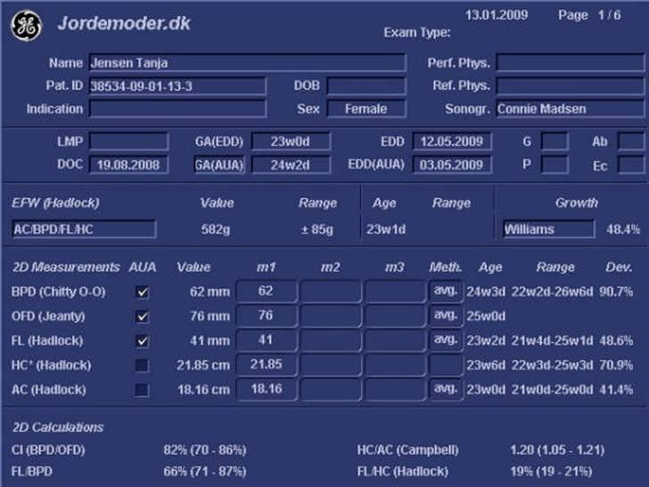 3D scannings billeder (2009) billede 35