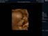 3D-scanning