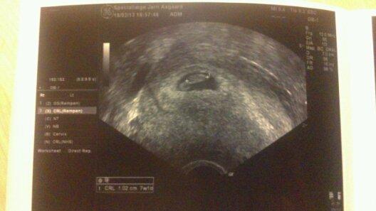Update: 7.ugers scanning idag