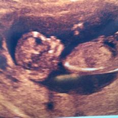 Pige Prinsesse Victoria <3