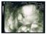 Dreng David - 3D/4D scanning 27+3