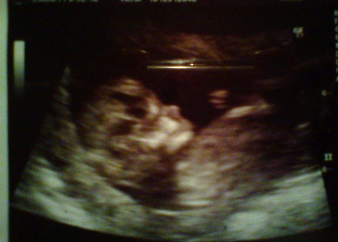 Dreng William - William til NF billede 1