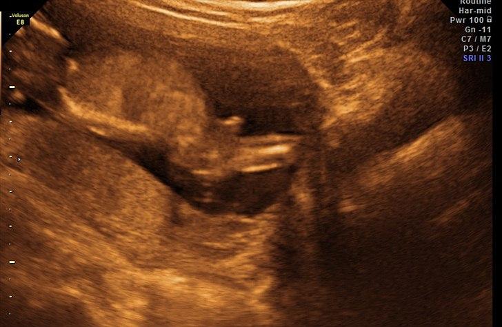 Dreng William - Williams lille tap :) billede 2