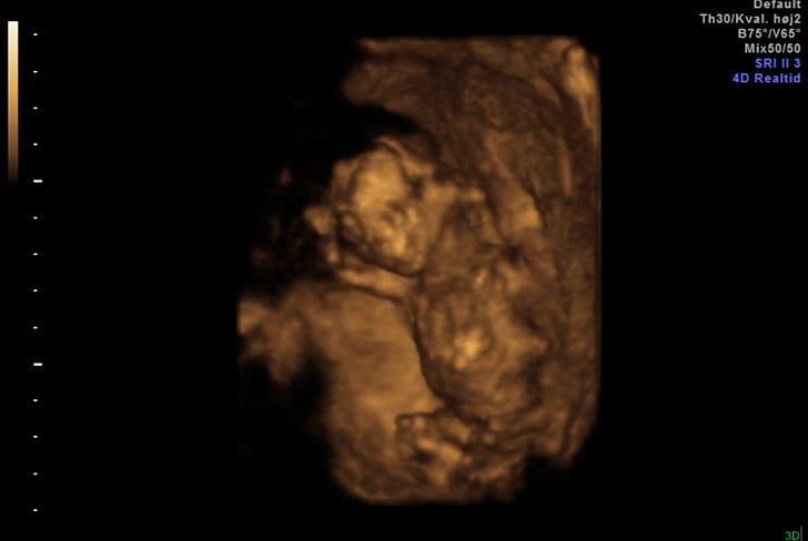 Dreng William - William i 3D billede 3