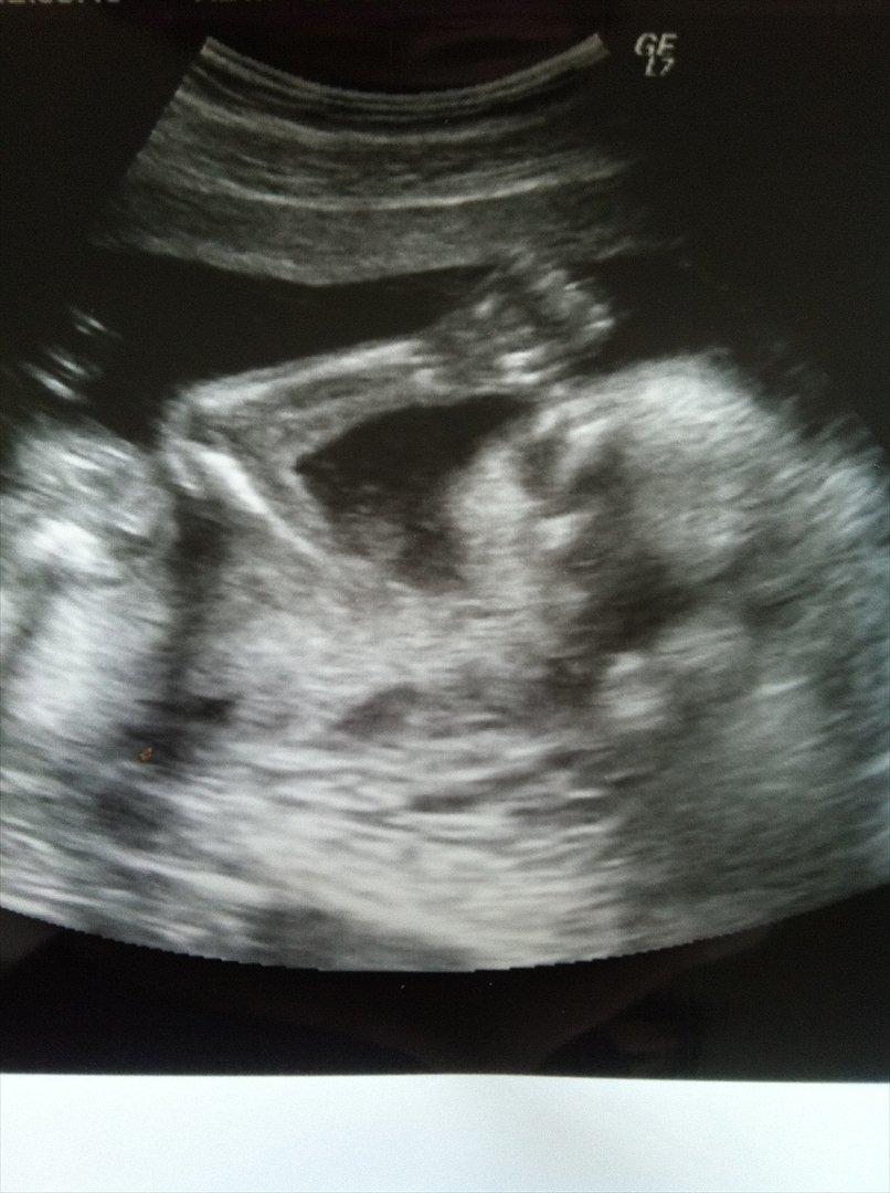 Pige Sophia billede 2