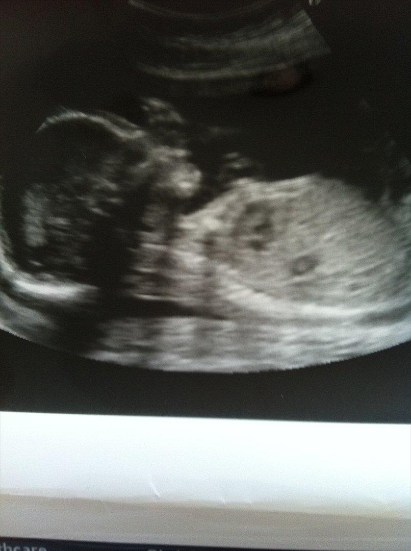 Pige Sophia billede 3