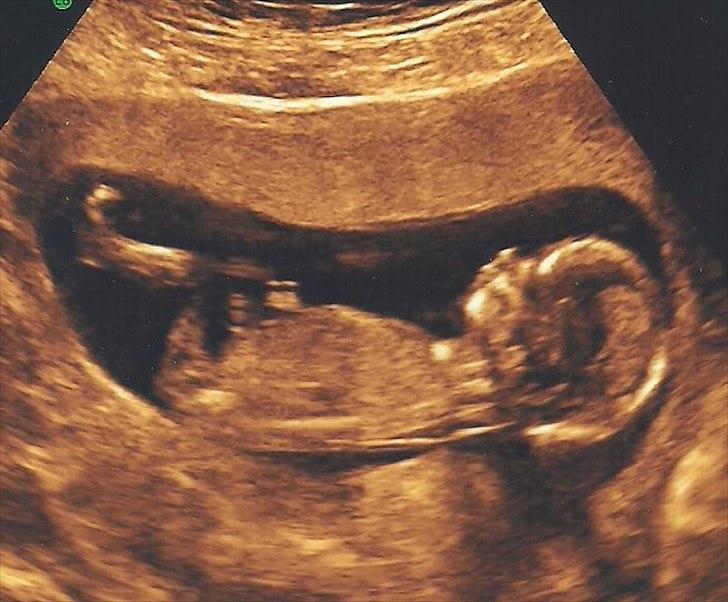 Dreng Marcus <3 - dig 13+4 billede 2