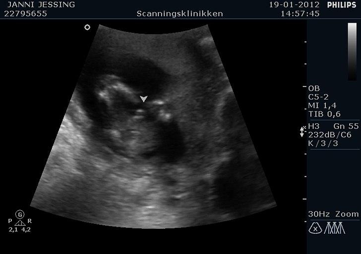 Dreng Marcus <3 - selv med kors lagte ben kan man se det er en lille dreng ;)  billede 5