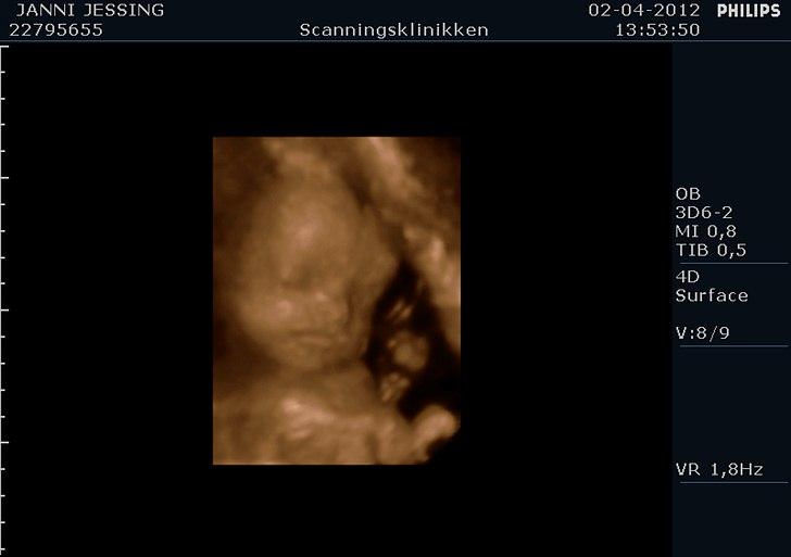 Dreng Marcus <3 - 3D 26+1 billede 6