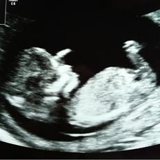 Dreng William Anker Paysen Kjærsgaard