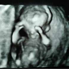 Dreng William Anker Paysen Kjærsgaard