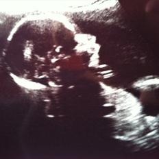 Dreng William Anker Paysen Kjærsgaard