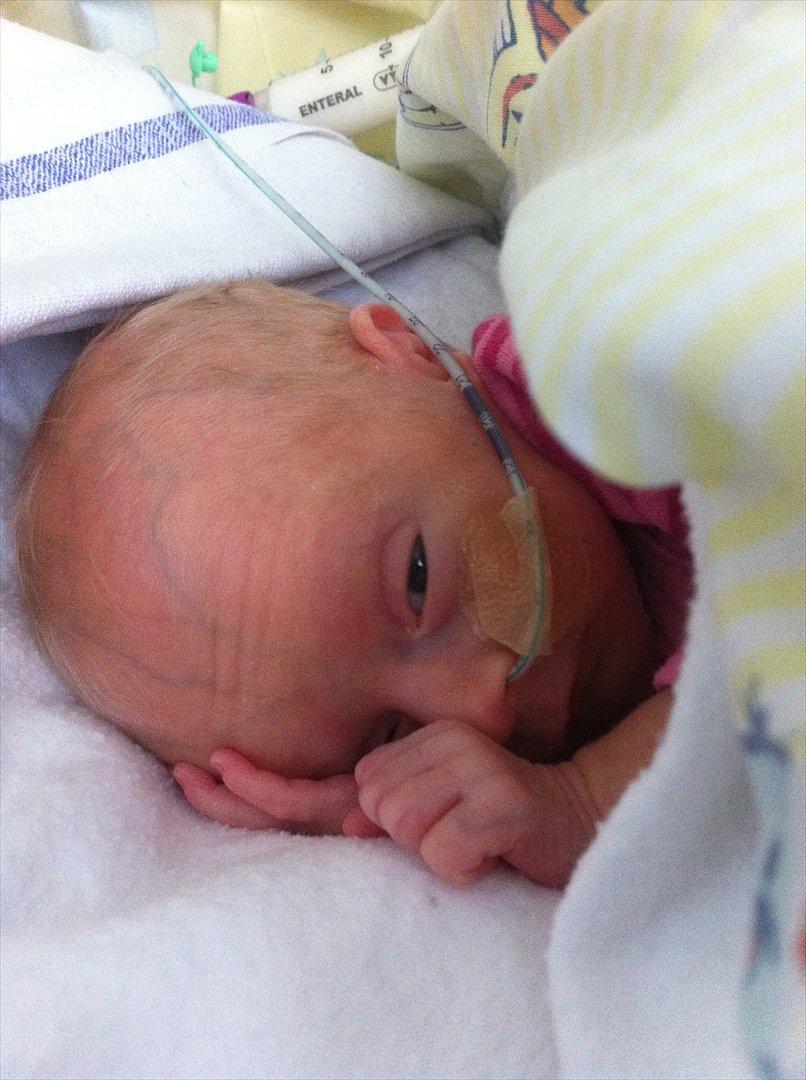 Pige Sophia Charlotte Aasted Wilson - Jeg fik mad igennem Sonden i 6 uger - er glad for at undvære den nu - ad bad billede 4