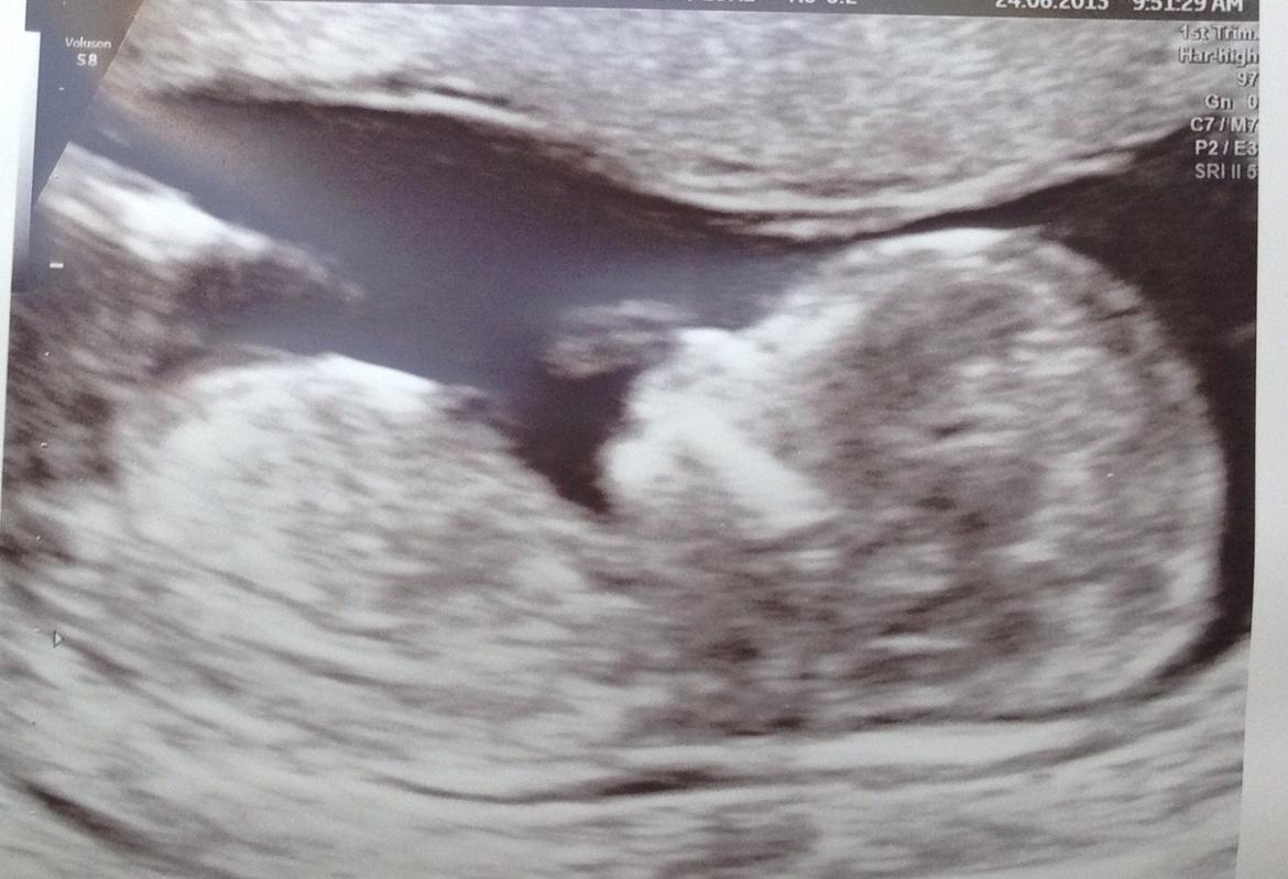 Dreng Adrian billede 11