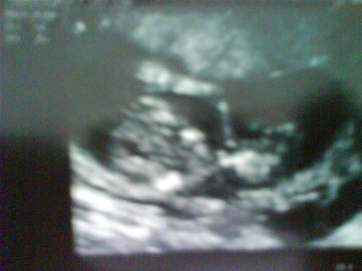 Pige Josephine sofie  - I min mor`s mave del 1. billede 2