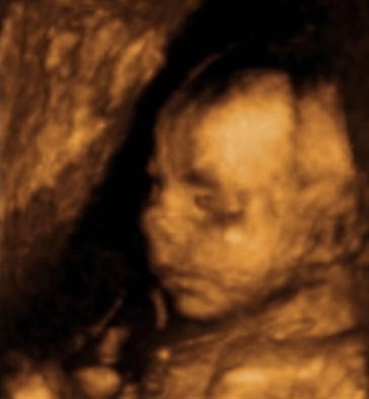 Pige Signe billede 1