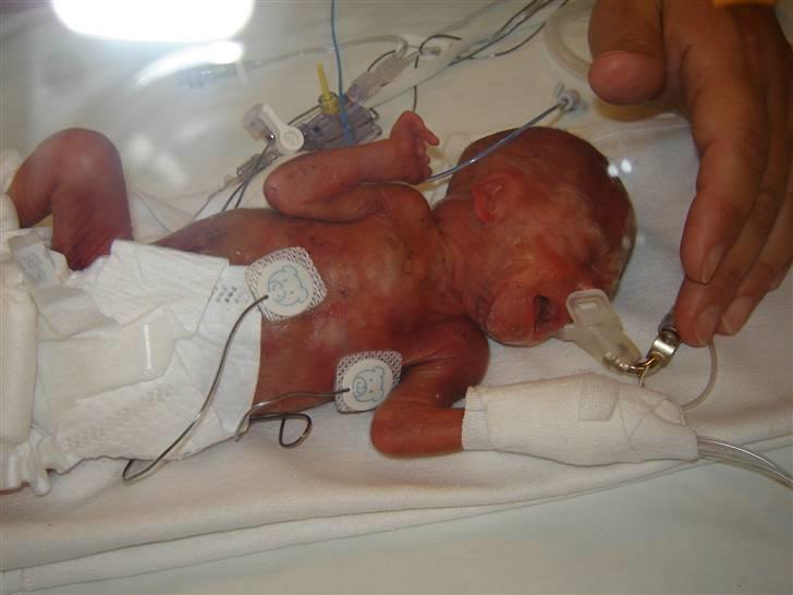 Dreng Damian billede 10