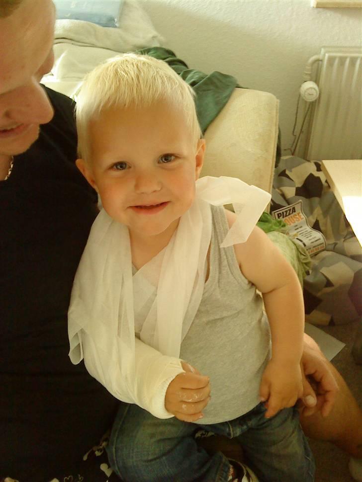 Dreng Tobias - Tobias med brækket håndled... :´( Og er nu 2 år gammel...  billede 20