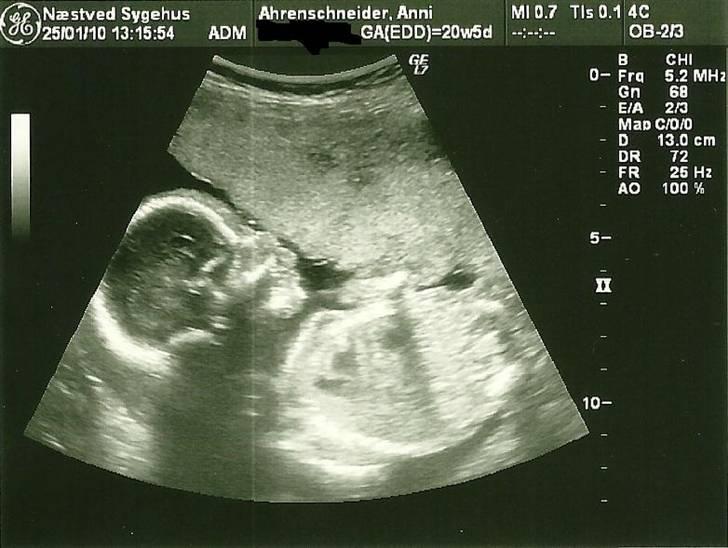 Dreng Sean billede 1