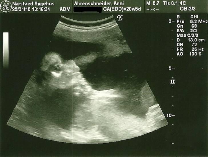 Dreng Sean - tænksom bebse med hånden under hagen :)  billede 2