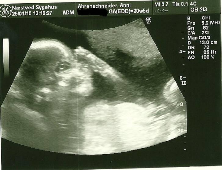 Dreng Sean - så suttes der tommelfinger :) billede 3