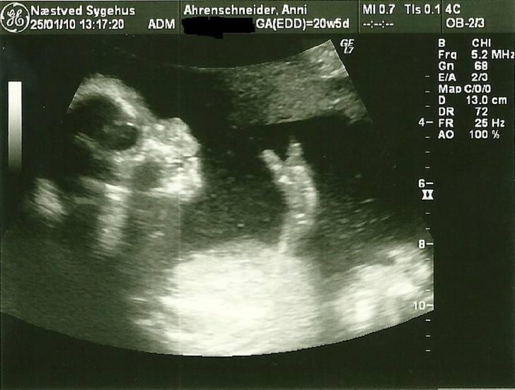 Dreng Sean - nej det er ikke et fusket billede det er et der er taget direkte fra skanningen og printet ud :) billede 4