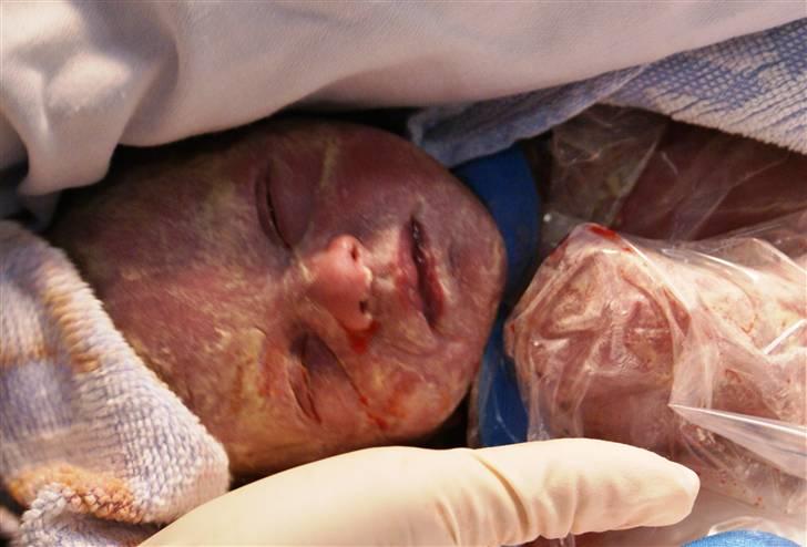 Pige Kaya Emilie - 1 min gammel stadig m fosterfedt billede 2