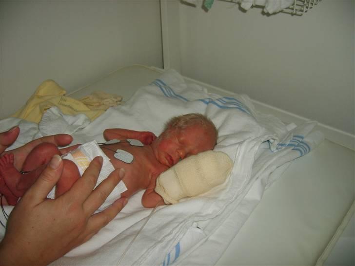 Pige Sofie - Sofie 1500 gram og 4 dage gammel billede 5