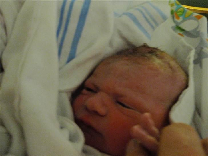 Dreng <3 Frederik <3 - Få minutter gammel her, blev taget ved kejsersnit efter 41 timer.. billede 4