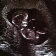 Pige Jolene marie ravn stausholm
