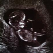 Pige Jolene marie ravn stausholm