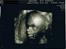 Dreng David - MD scanning 20+1 :)