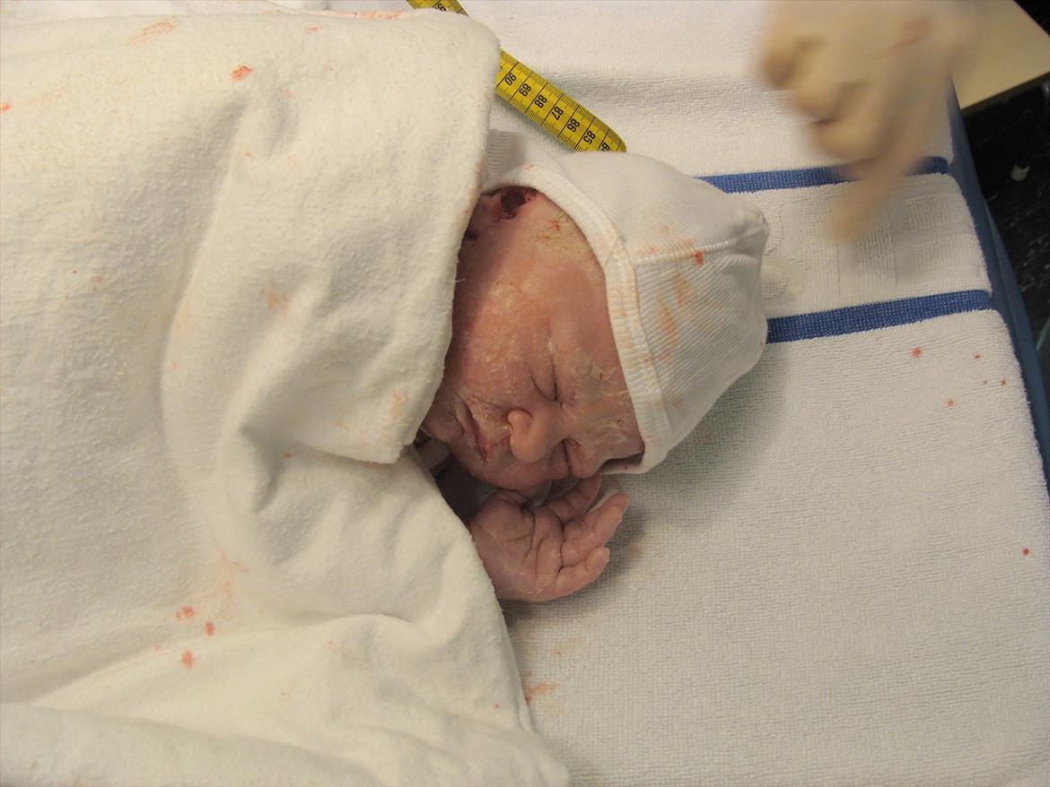Pige Annesofie billede 1