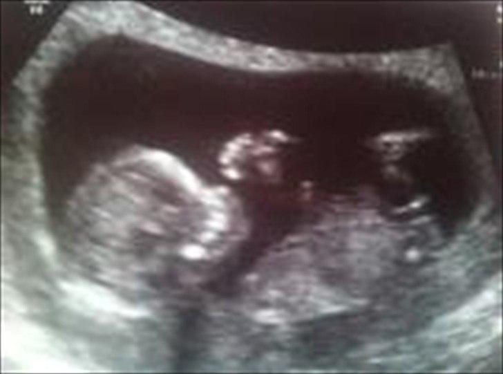 Dreng Silas - NF 10-10-2011
13+0 billede 3