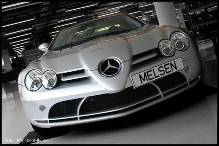 Mercedes SLR MCLaren billede 1