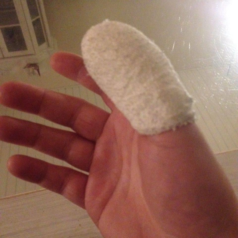 Klemt finger... billede 5