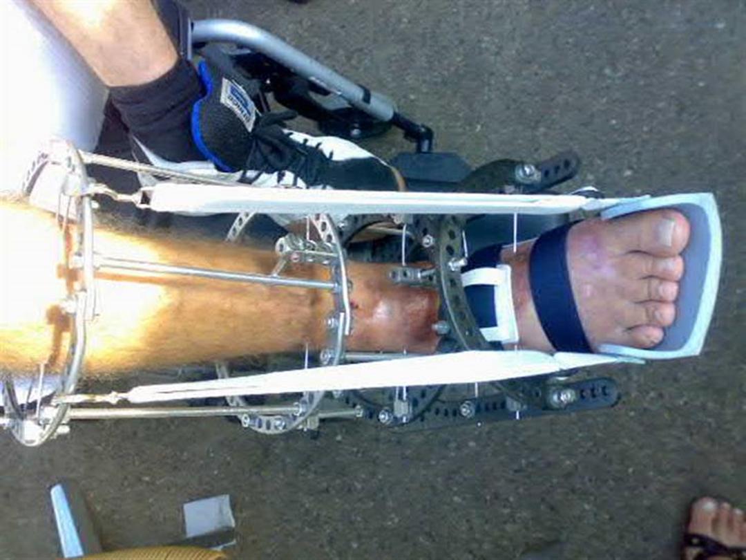 Mit ben efter en tidligere bekendt kørte ind i mig - Off - Uploadet af DGD a